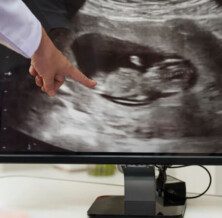 Ultrasound At 8 Weeks Pregnant