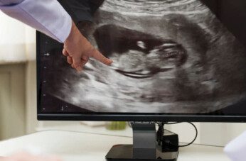 Ultrasound At 8 Weeks Pregnant