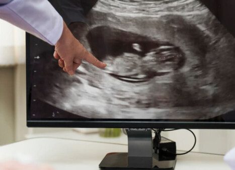 Ultrasound At 8 Weeks Pregnant