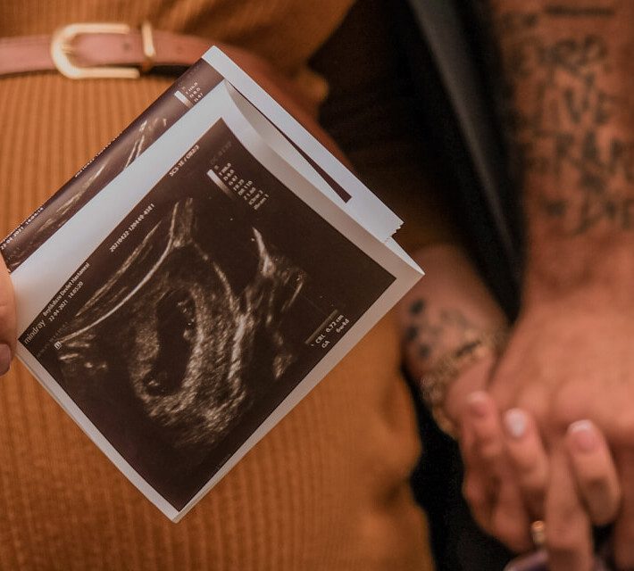 Ultrasound Of A 5 Week Pregnancy
