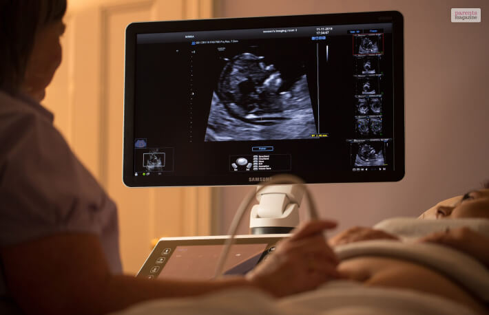 Ultrasounds 12 Weeks: Why Is It Important?