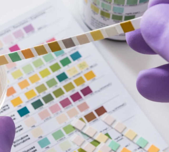 Protein In Urine During Pregnancy