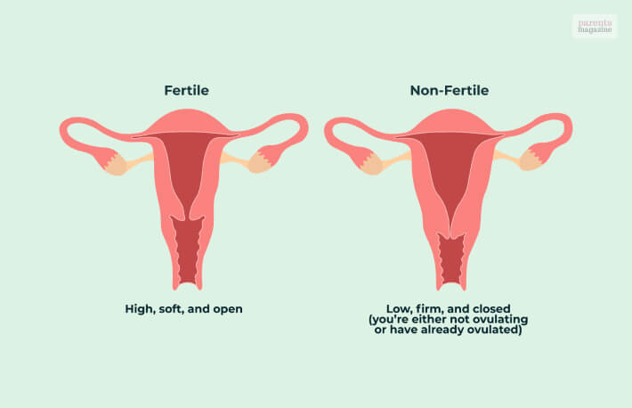 Cervix Height And Firmness