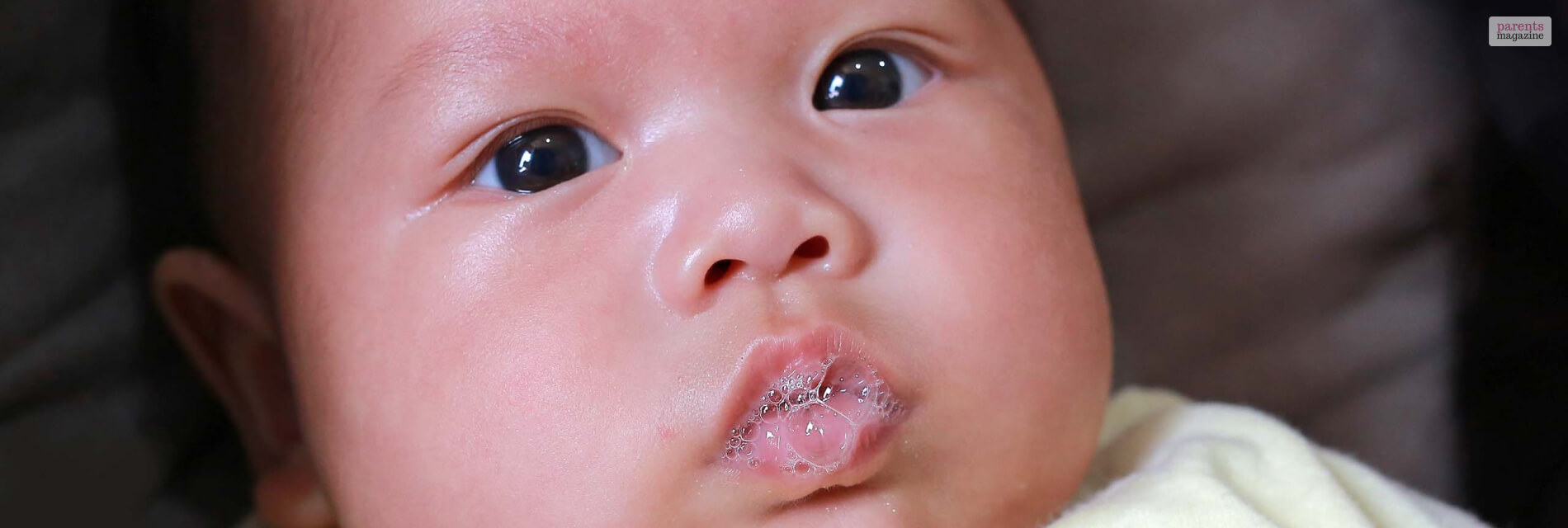 Understanding and Treating Drool Rash in Babies A Comprehensive Guide