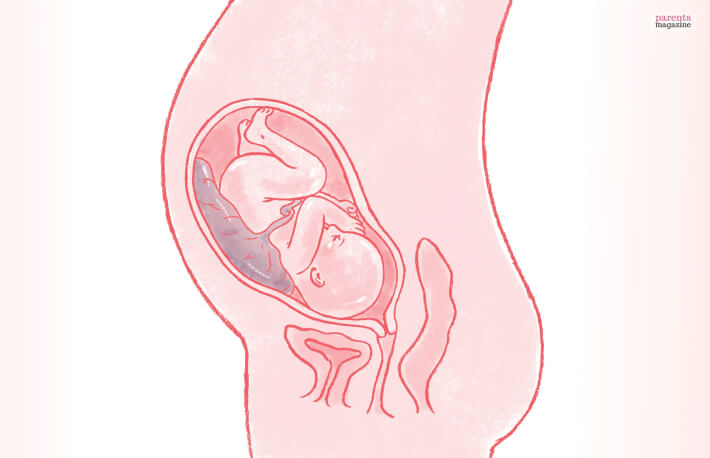 Can having an anterior placenta affect your pregnancy