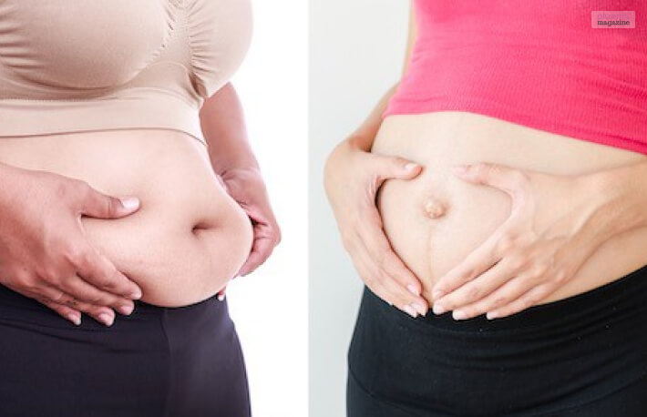 Pregnant Belly Vs Fat Belly Difference