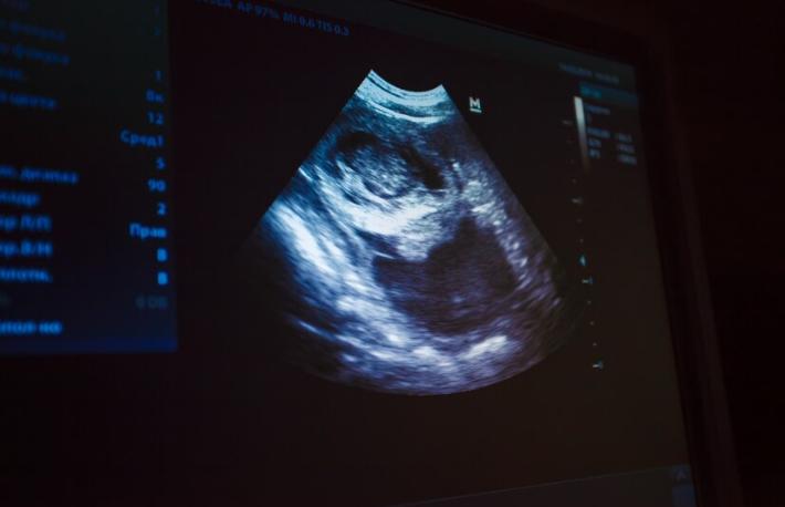 Risks Of Internal Fetal Monitor