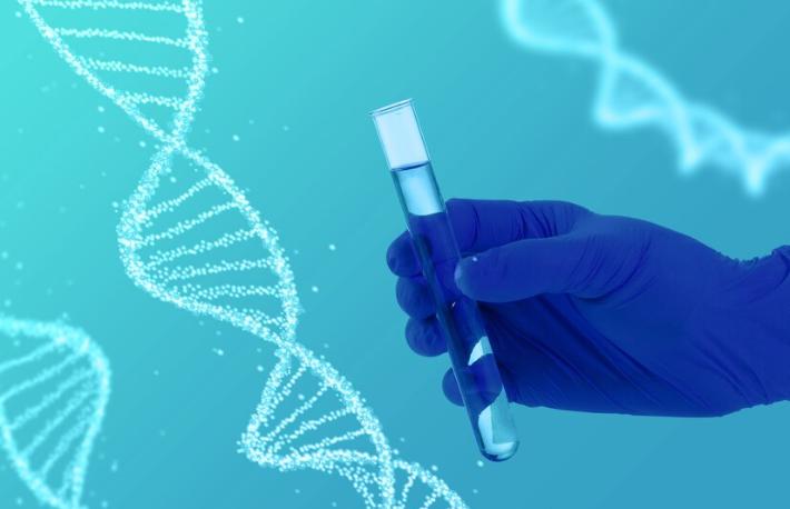 Which Is Better cvs vs amniocentesis