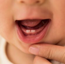 Baby Grinding Teeth