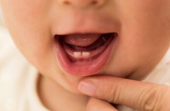 Baby Grinding Teeth