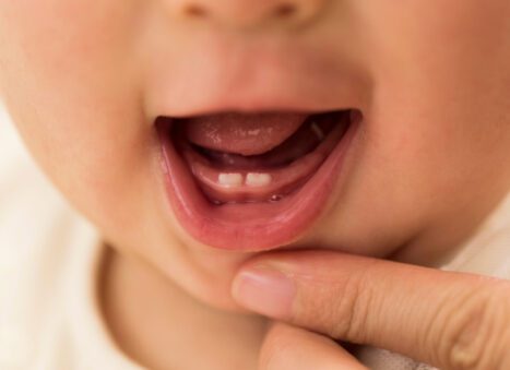 Baby Grinding Teeth