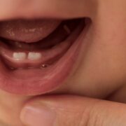 Baby Grinding Teeth