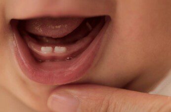 Baby Grinding Teeth