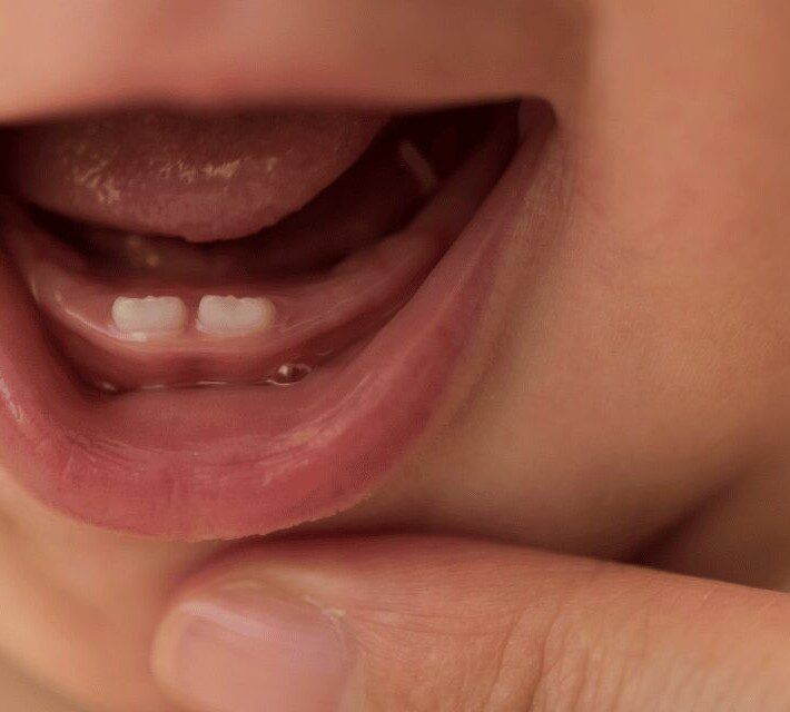 Baby Grinding Teeth