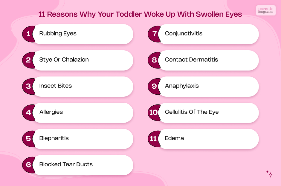 11 Reasons Why Your Toddler Woke Up with Swollen Eyes