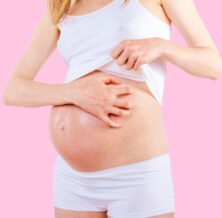 Itching during pregnancy