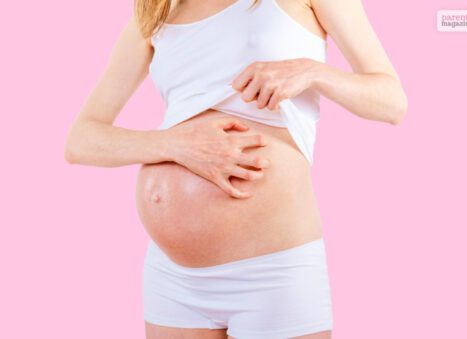 Itching during pregnancy