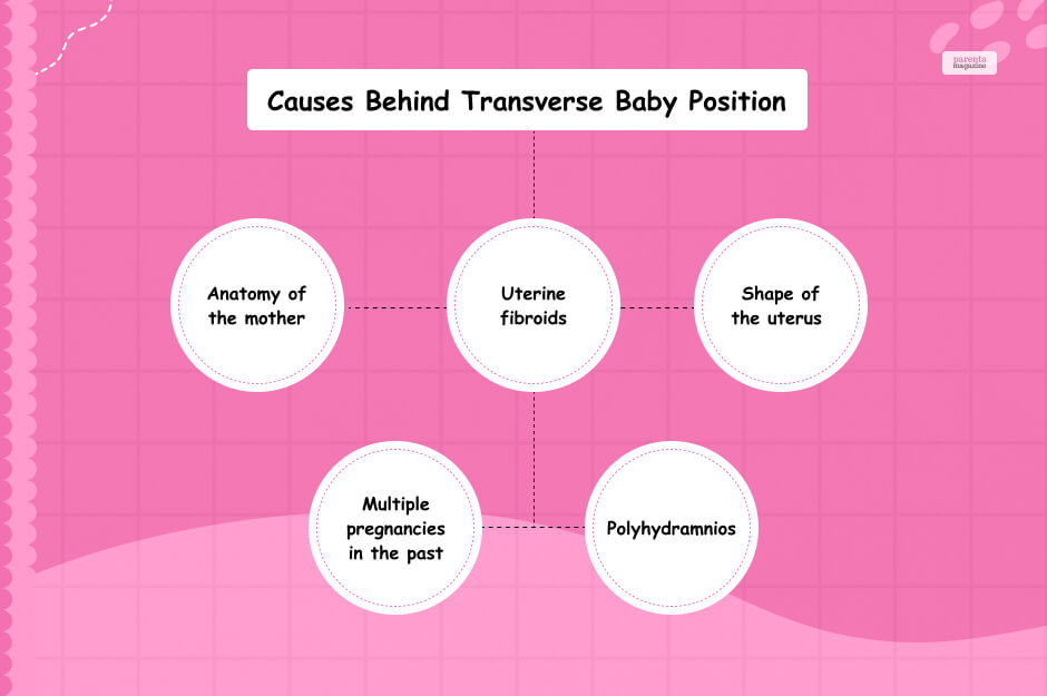 Causes Behind Transverse Baby Position