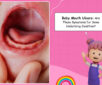 baby mouth ulcer