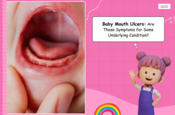 baby mouth ulcer