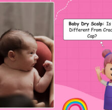 Baby dry scalp