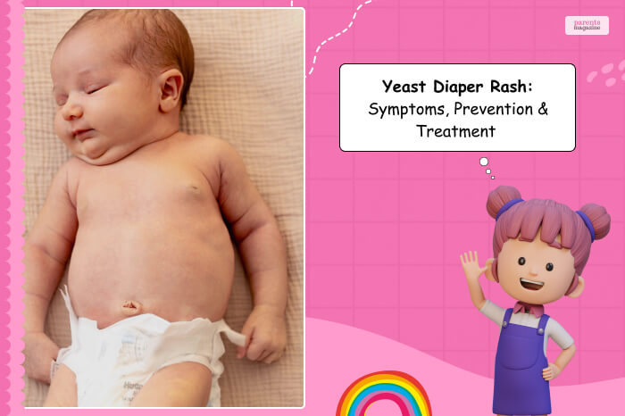 Yeast diaper rash