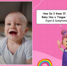 How do I know if my baby has a tongue tie